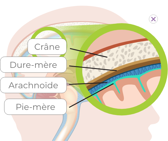 head with details